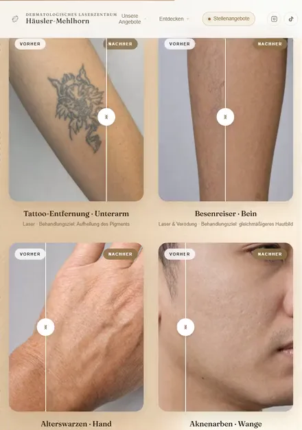Vorher-Nachher-Vergleiche des Laserzentrums H&auml;usler-Mehlhorn auf dem Tablet: Schieberegler zeigen Tattoo-Entfernung, Besenreiser, Alterswarzen und Aknenarben